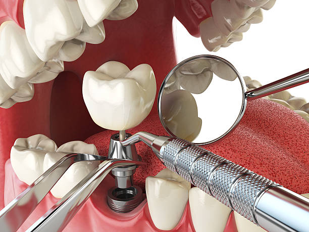 Best Weekend Emergency Dentist in Snellville, GA